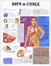 Показания для кесарева сечения / ВИЧ и СПИД. Плакат