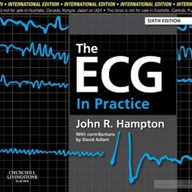 The ECG in Practice
